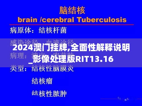 2024澳门挂牌,全面性解释说明_影像处理版RIT13.16