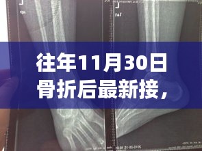 往年11月30日骨折后的最新接骨技术与康复策略进展