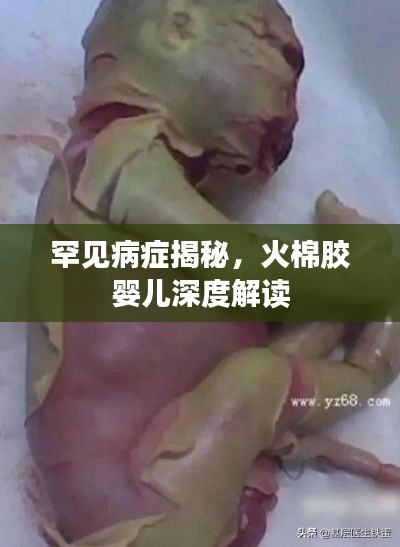 罕见病症揭秘，火棉胶婴儿深度解读