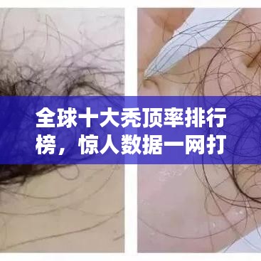 全球十大秃顶率排行榜，惊人数据一网打尽！
