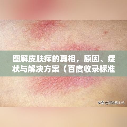 图解皮肤痒的真相，原因、症状与解决方案（百度收录标准）